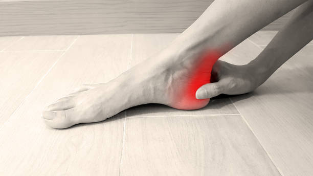 Plantar fasciitis